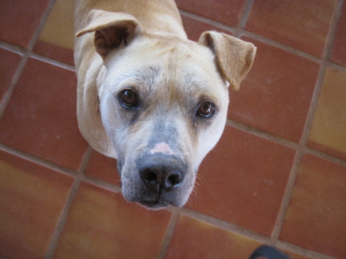 Metatarsal Stress Fracture. metatarsal+stress+fracture